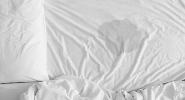 Wet patch on white bed sheets after a child has wet the bed.